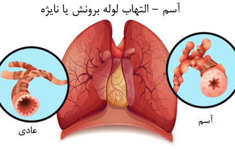 آسم را جدی بگیرید